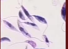 Leishmanie